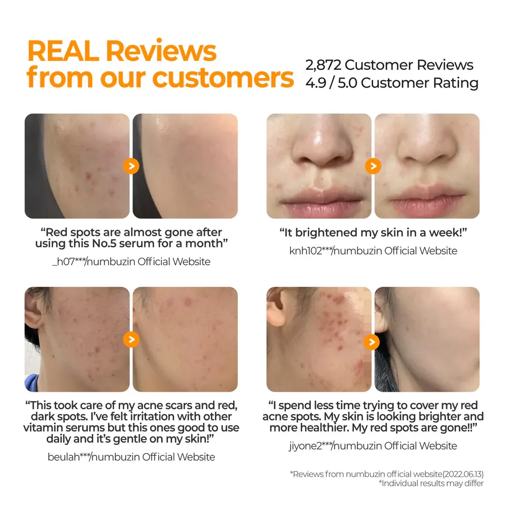 سرم ضد لک نامبوزین شماره ۵ Goodbye Blemish حجم ۵۰ میل - Image 5